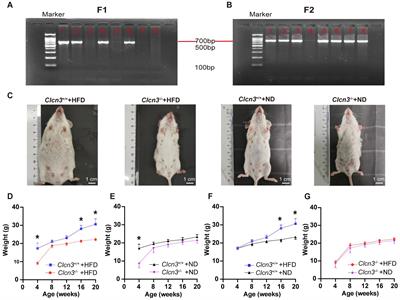 Clcn3 deficiency ameliorates high-fat diet-induced obesity and improves metabolism in mice